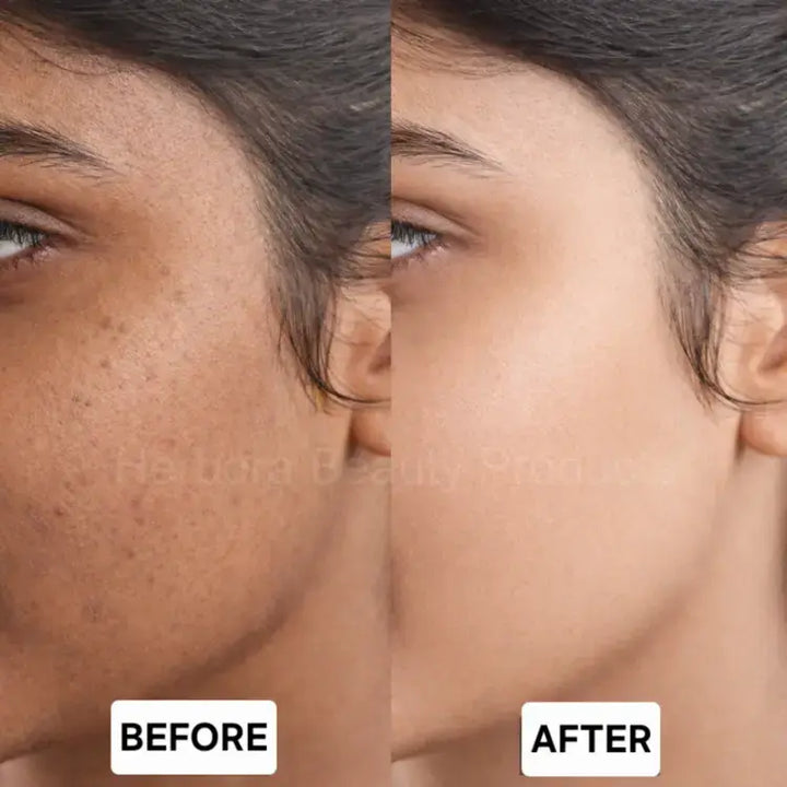 Before and after result