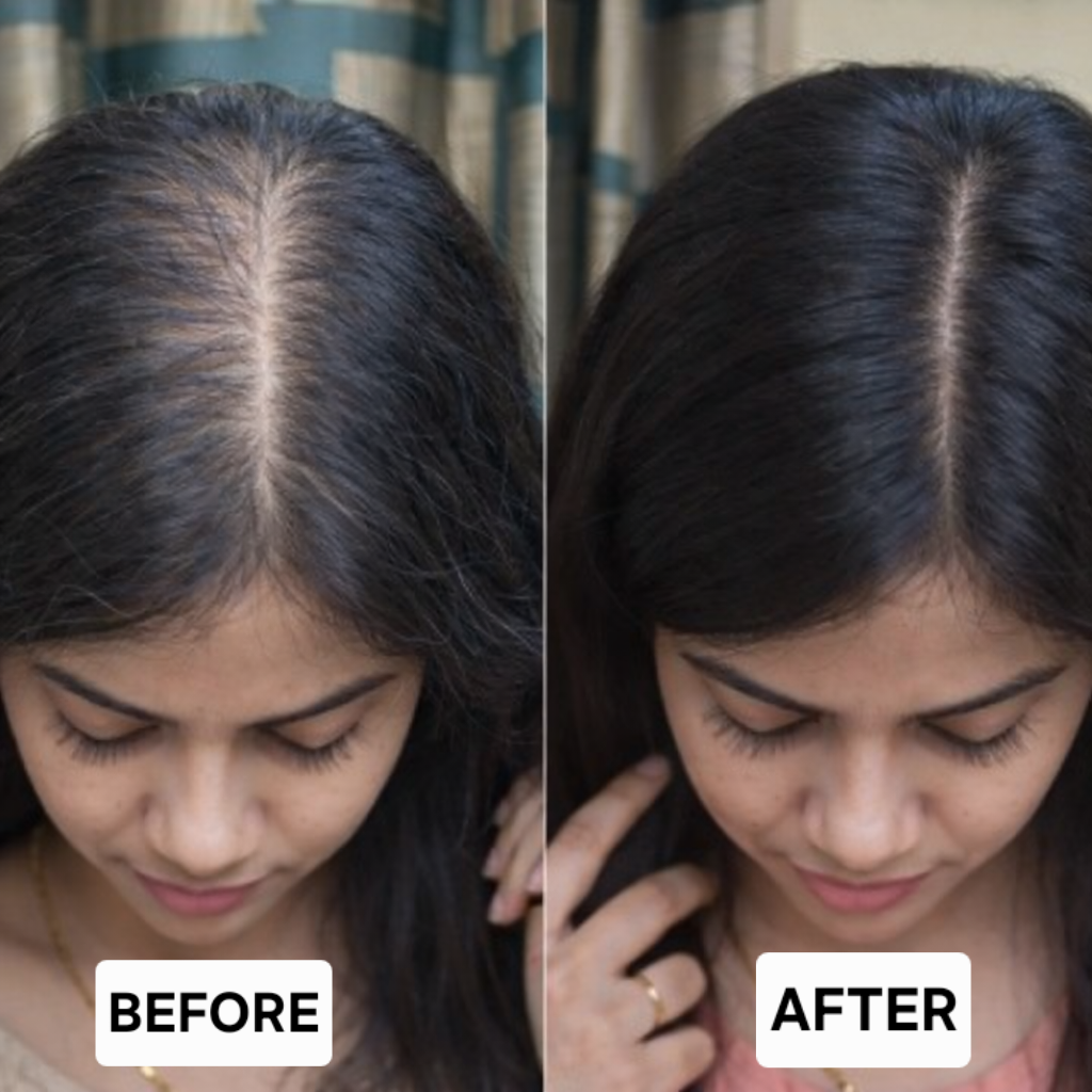 HAIR REVIVAL OIL - Best for Hairfall Control, Damage Repair and Hair Growth