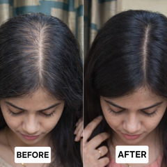 HAIR REVIVAL OIL - Best for Hairfall Control, Damage Repair and Hair Growth