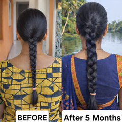 HAIR REVIVAL OIL - Best for Hairfall Control, Damage Repair and Hair Growth